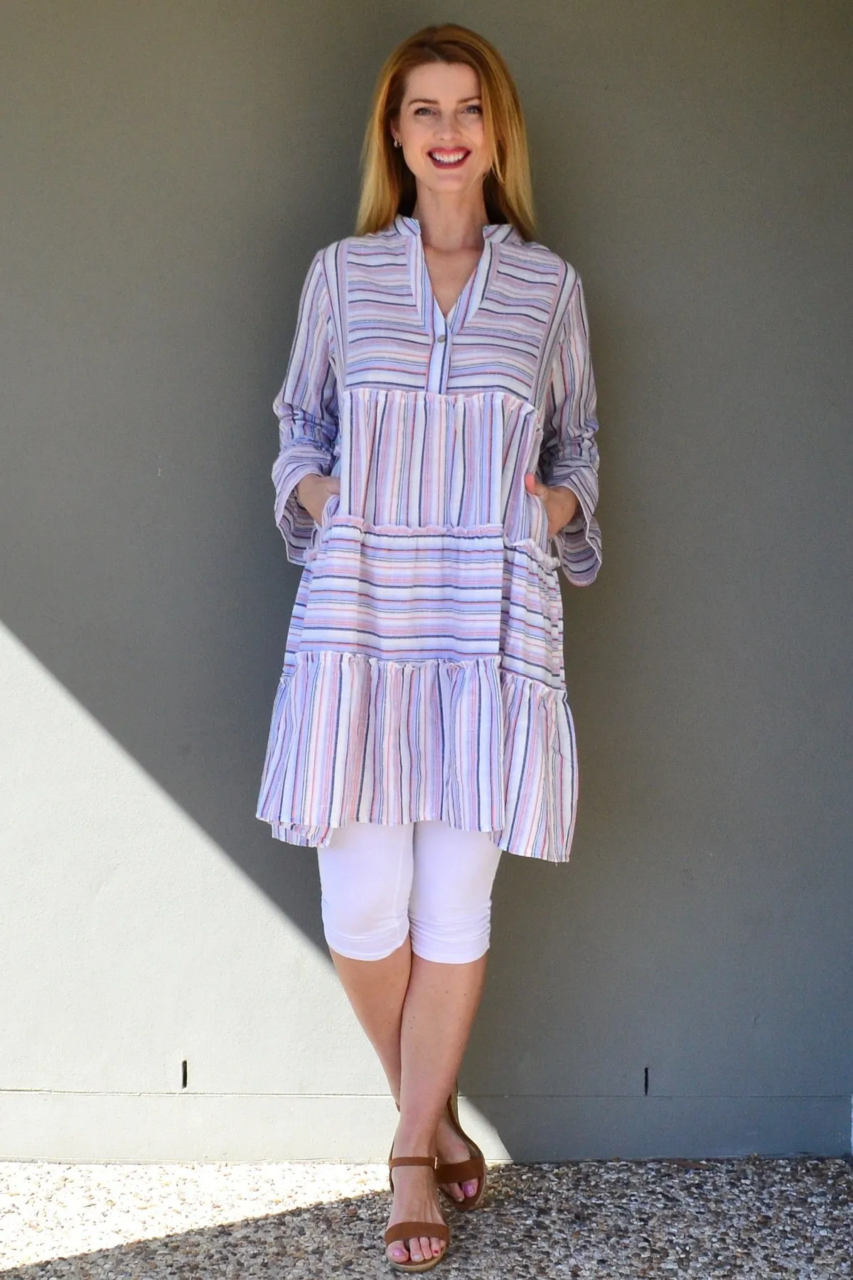 Striped Delight Summer Tunic Dress